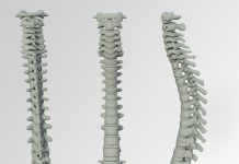 טיפול בכאבי גב על ידי פיזיותרפיה טיפול בכאבי גב על ידי פיזיותרפיה