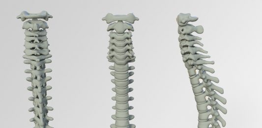 טיפול בכאבי גב על ידי פיזיותרפיה