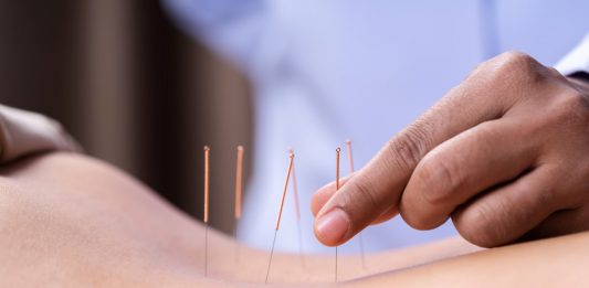 מתמודדים עם הכאב בעזרת דיקור סיני